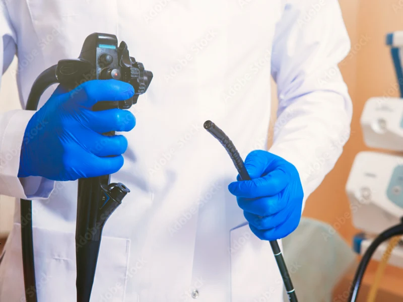 Foto do exame Endoscopia